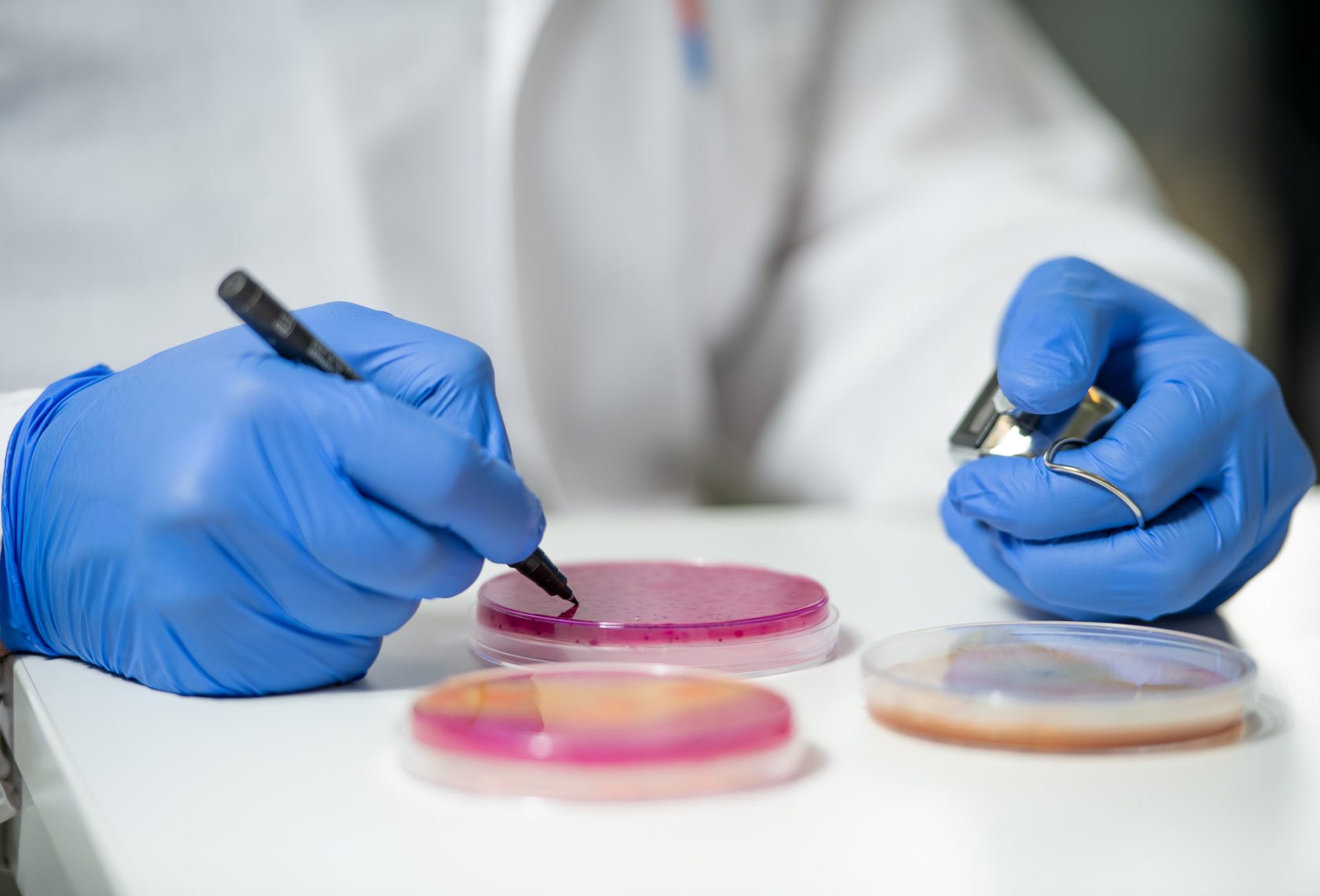 Hände mit Petrischale